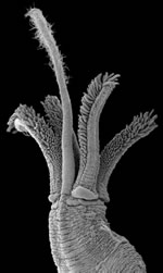 Electron micrograph of Osedax mucofloris, the marine worm species Adrian Glover discovered in 2005 and hopes to study using the underwater observatory. 
